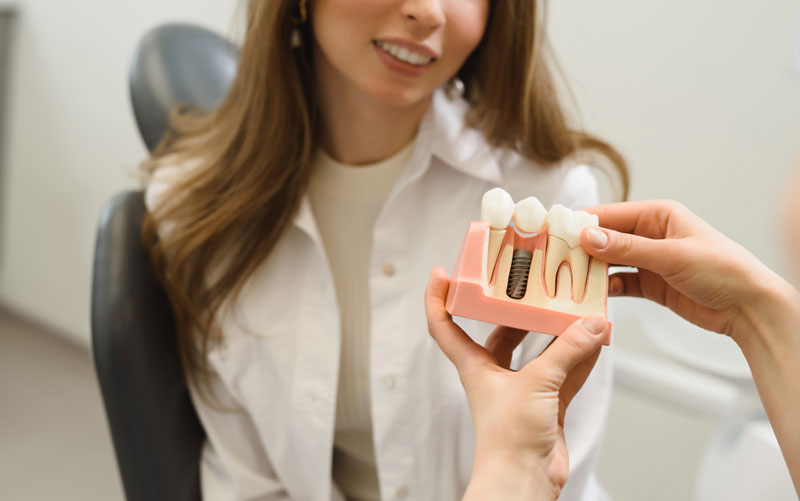 Unlocking the Benefits of Dentist Denture Implants – A Comprehensive Guide