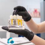 Dental expert holding human teeth model, pointing to the crown of a dental implant, and offering advice on dental implant maintenance and healthy teeth care.